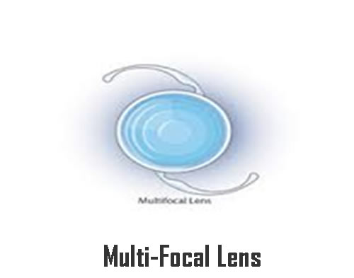 Multi-Focal Lens